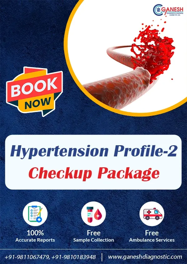 Hypertension Profile-2 Checkup Package